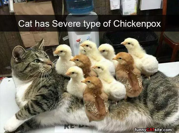 Severe Case Of Chicken Pox
